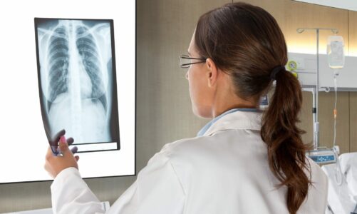 Hunterdon Asthma Doctors