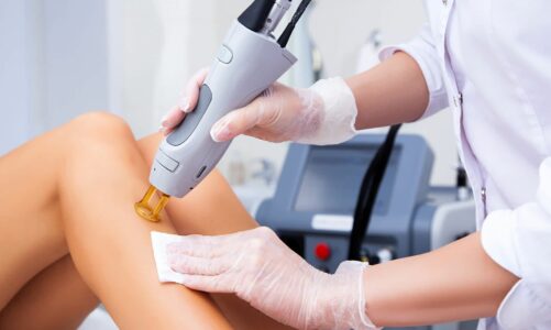 What is a Laser Hair Removal Atlanta?